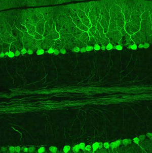 L7cerebellum