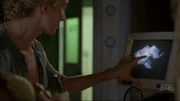 800px-Sun Ultrasound.jpg