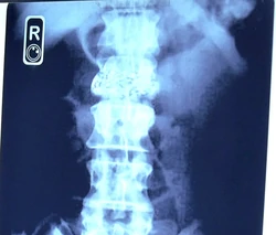 Xray.JPG