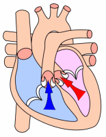 Heart systole