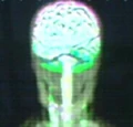 Aenar brain.jpg