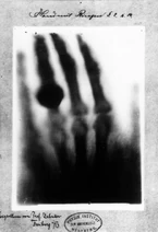 Anna Berthe Roentgen