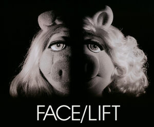 Facelift