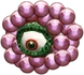 Wart