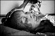 Cambodia AIDS Victim.jpg