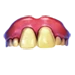 Fake Teeth