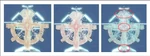 Wraparound