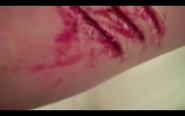 Rake wounds