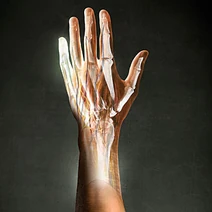 Lostlimbs