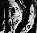 Psychosis