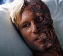 Harvey Dent (Nolanverse)