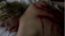 Sookie scar.jpg