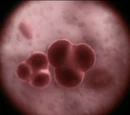 Corvinus Strain