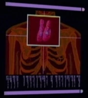 A scan of Susanna Leijten's upper chest showing the thymus
