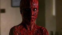 A vision of a doctor skinned alive